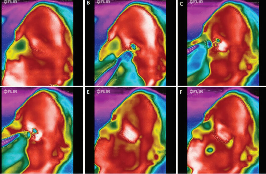 Adjunct Treatments for Dry Eye Disease